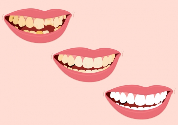 Dentisterie esth&eacute;tique